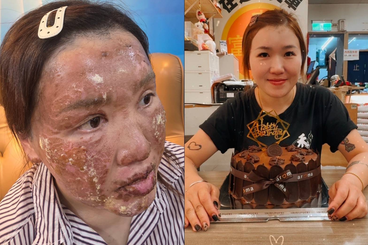 鄭女原本面容姣好（圖右），氣爆當下首當其衝幾近毀容（圖左）。（圖／民眾提供）