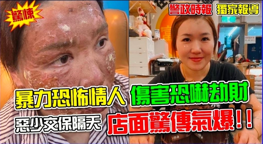 【獨家有影】必比登名店氣爆女子幾近毀容　揭「恐怖情人」楊萬來惡行：家暴令氣爆後才下來